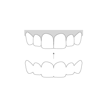 Estética dental Ortodoncia invisible