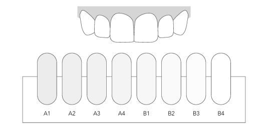 Estética dental Blanqueamiento dental