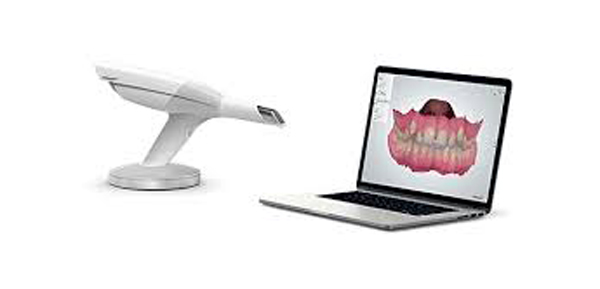 escaner intraoral escaner intraoral