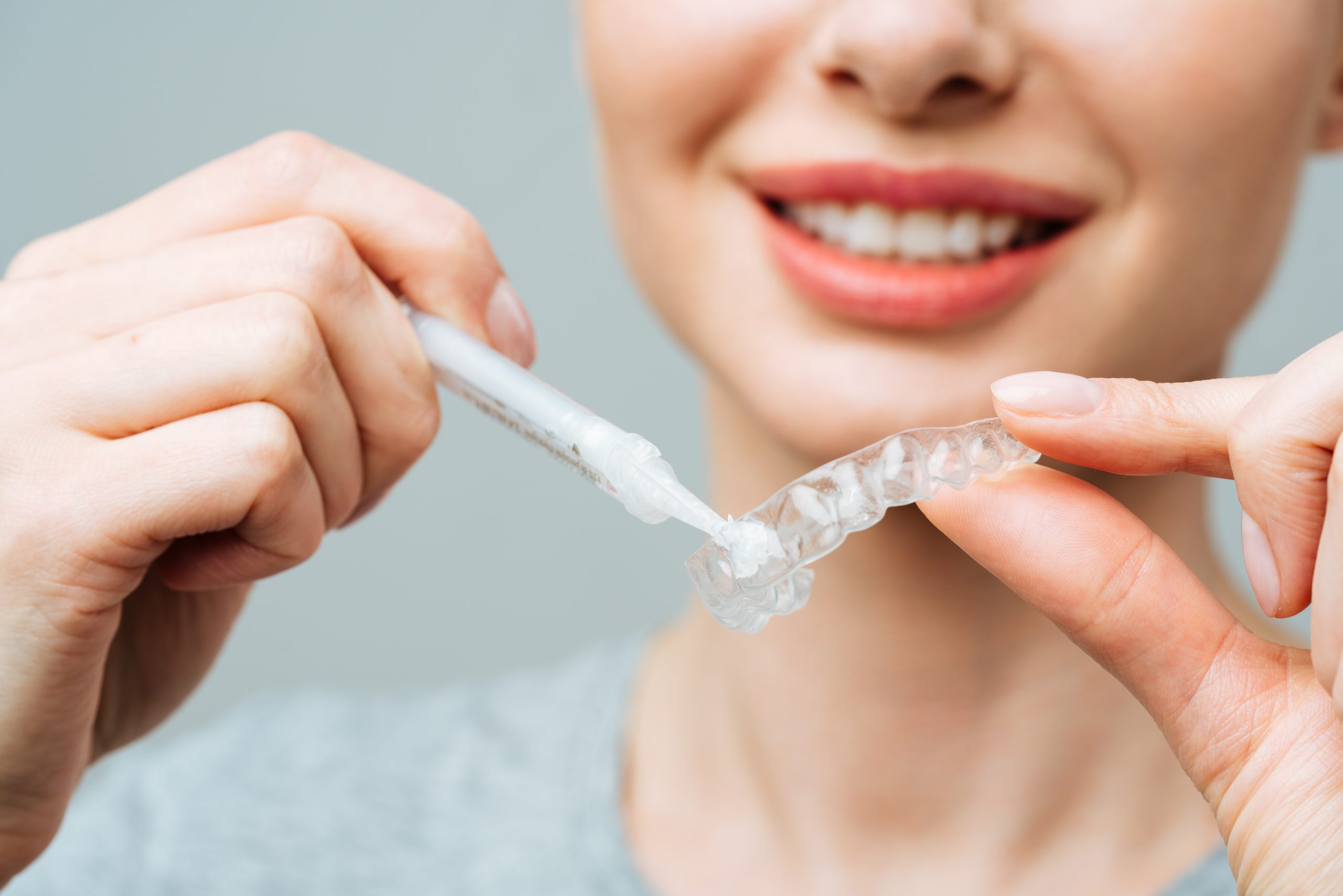 Limpieza de Férula dental
