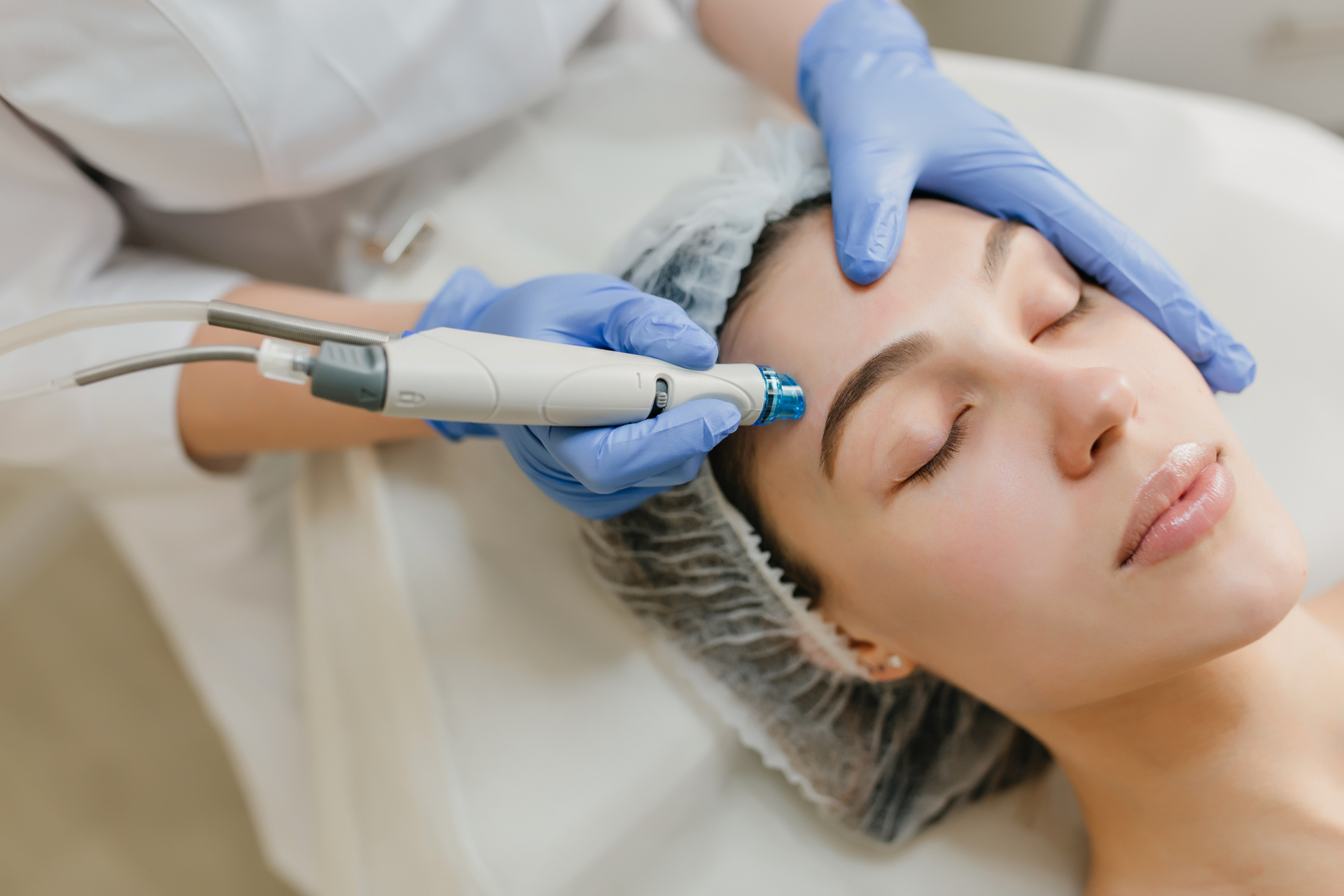 Microneedling facial para estimular con colágeno y rejuvenecer la piel